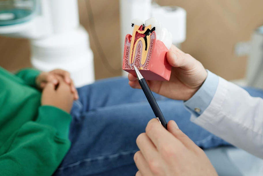 Root Canal Recovery