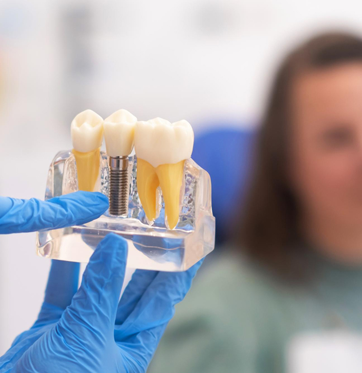 Dental Implants in Fullerton